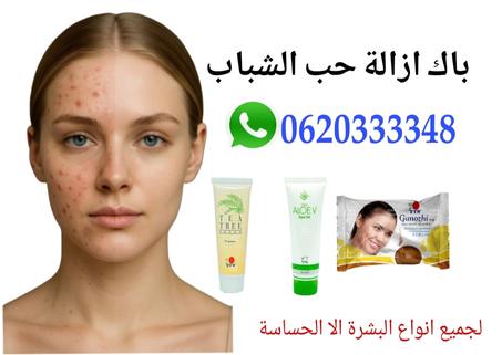 علاج حب الشباب
