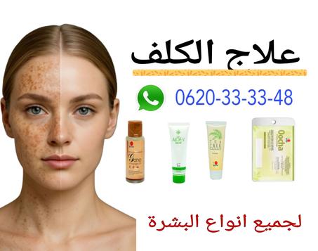علاج الكلف وتصبغات البشرة