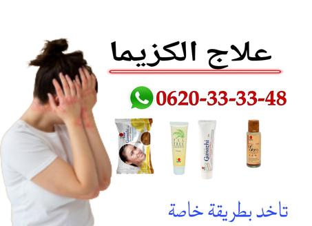 علاج الكزيما والصدفية