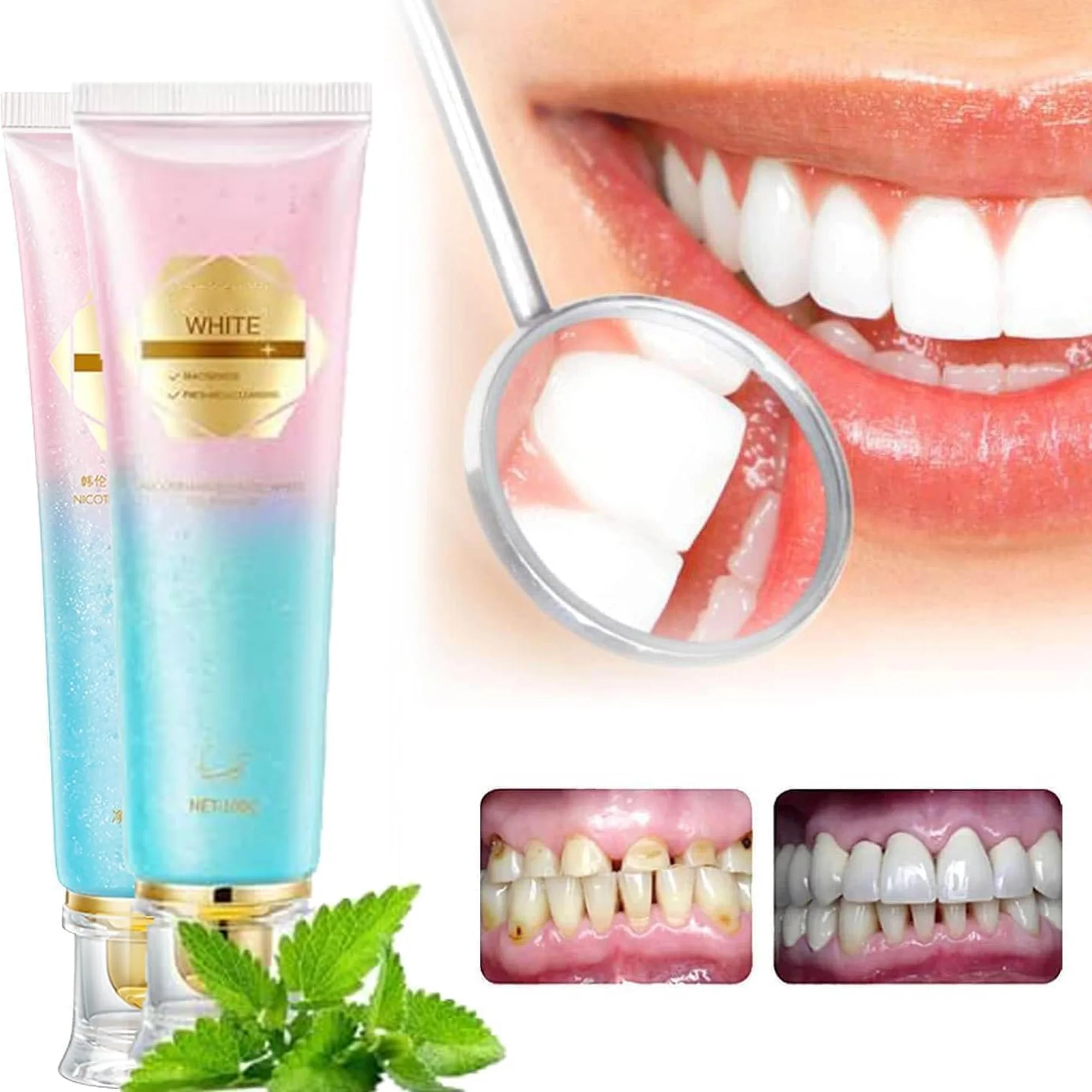 معجون أسنان مبيض بالنياسيناميد يزيل بقع الأسنان