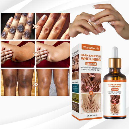 Suero blanqueador Dark Knuckle