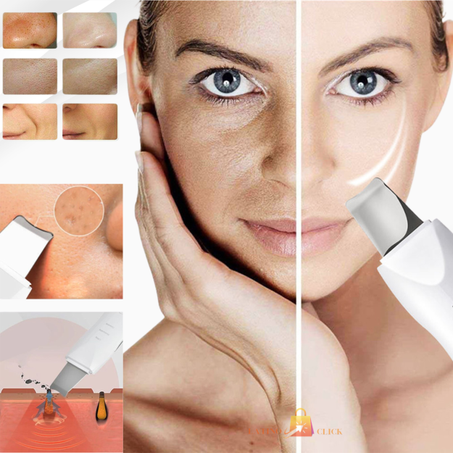 Máquina de limpieza facial profunda