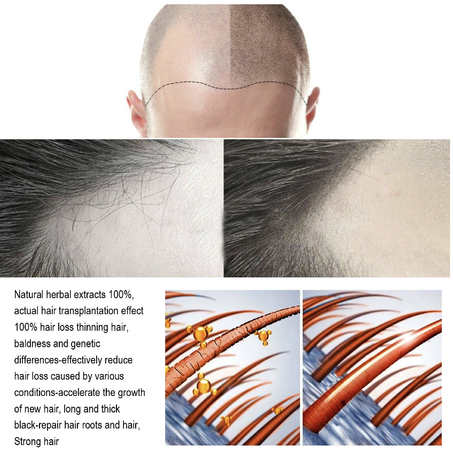 Ginger Hair Growth Nourishing Spray - بخاخ معالجة الشعر بالزنجبيل الأخضر لنمو الشعر