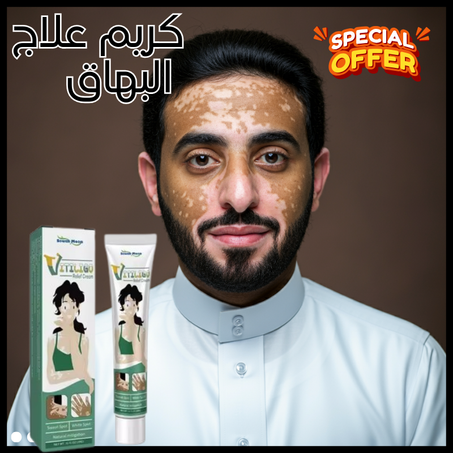 كريم البهاق