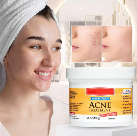 مرهم ديلاكروز ACNE : الحل اللي يعيد لبشرتك النقاء من جديد