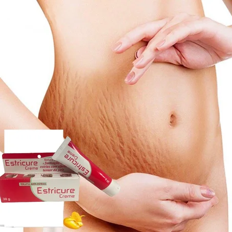 Estricure Creme: Redefina Sua Jornada Materna com Confiança