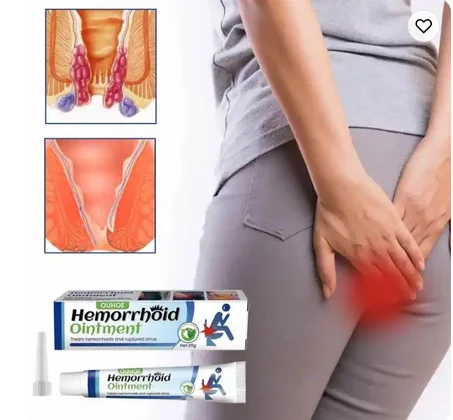 cream para hemorróidas proporciona alívio rápido e eficaz