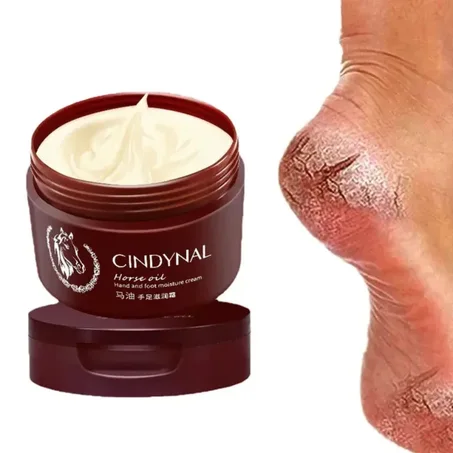 REMEDE EFFICACE POUR AVOIR UNE SUPERBE PAUME ET DES PIEDS COMME UN BEBE A SEULEMENT QUELQUE JOURS SANS EFFORT !!!