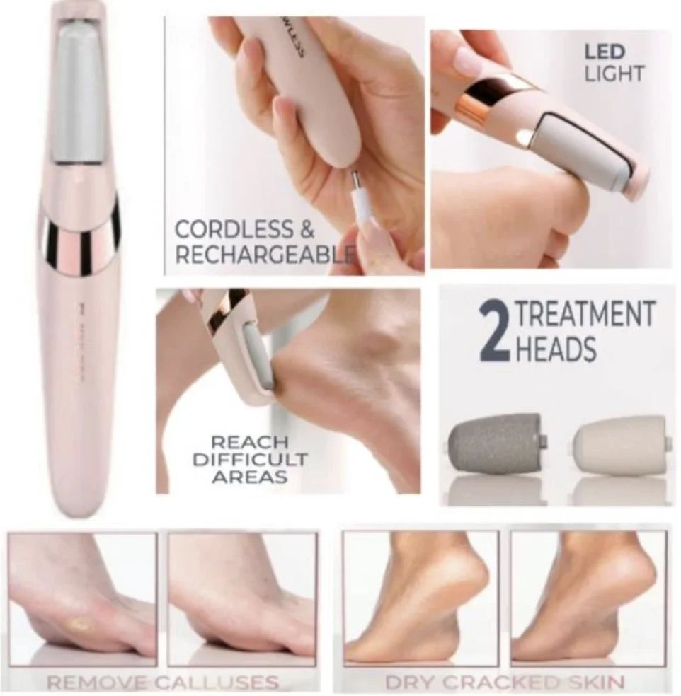 مقشر القدمين الكهربائي