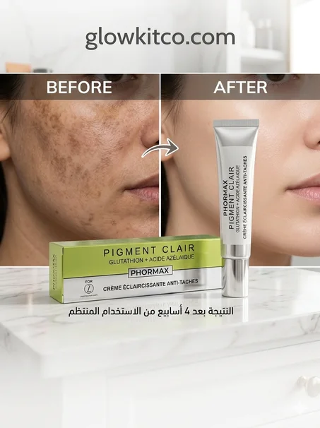 كريم التفتيح للبقع والكلف وآثار الحبوب PHORMAX PIGMENT CLAIR