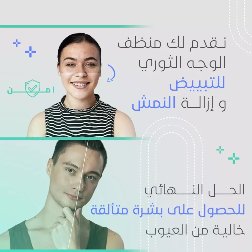 مزيل النمش لتبييض البشرة