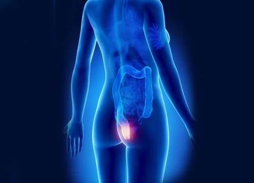 Ungüento calmante para hemorroides internas y externas