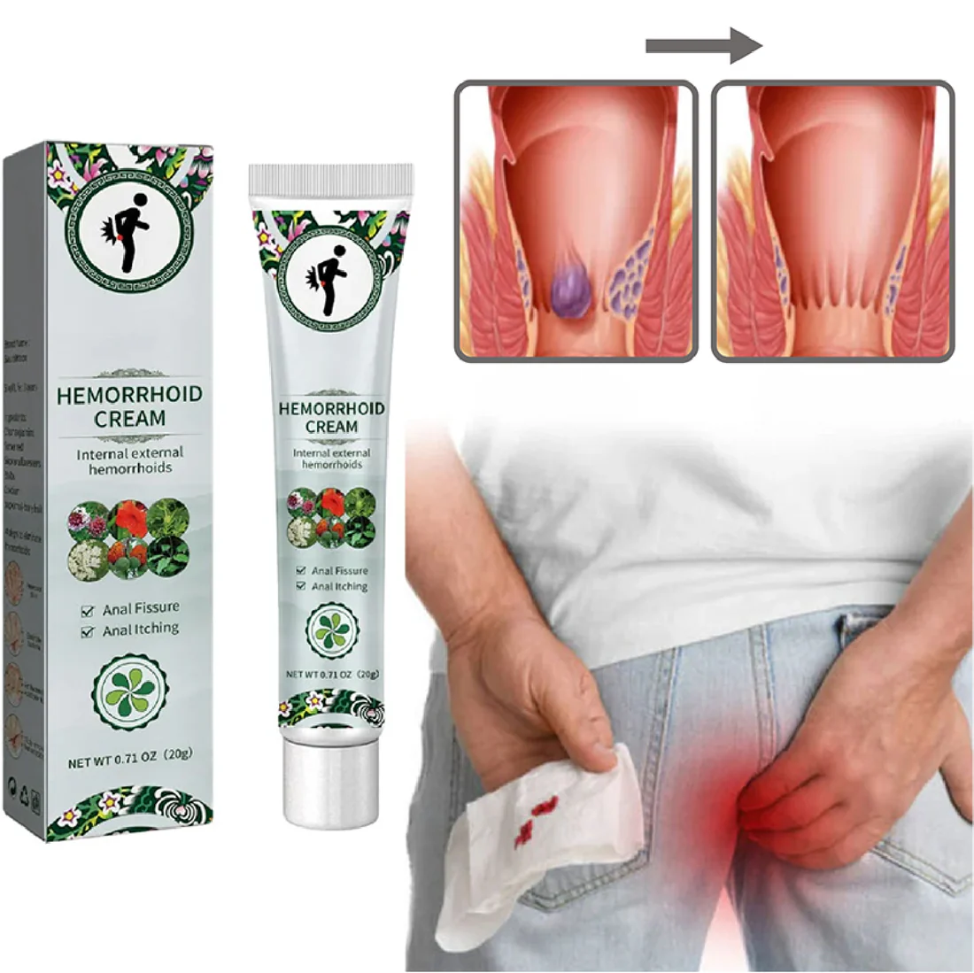 Ungüento calmante para hemorroides internas y externas