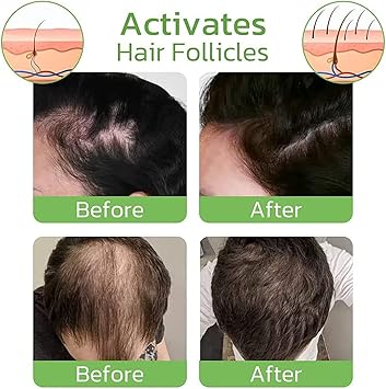 Spray de Jengibre para el Cabello: Nutrición y Crecimiento Natural