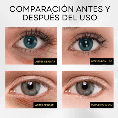 Sérum Quita Ojeras: Solución Avanzada para un Contorno de Ojos Perfecto