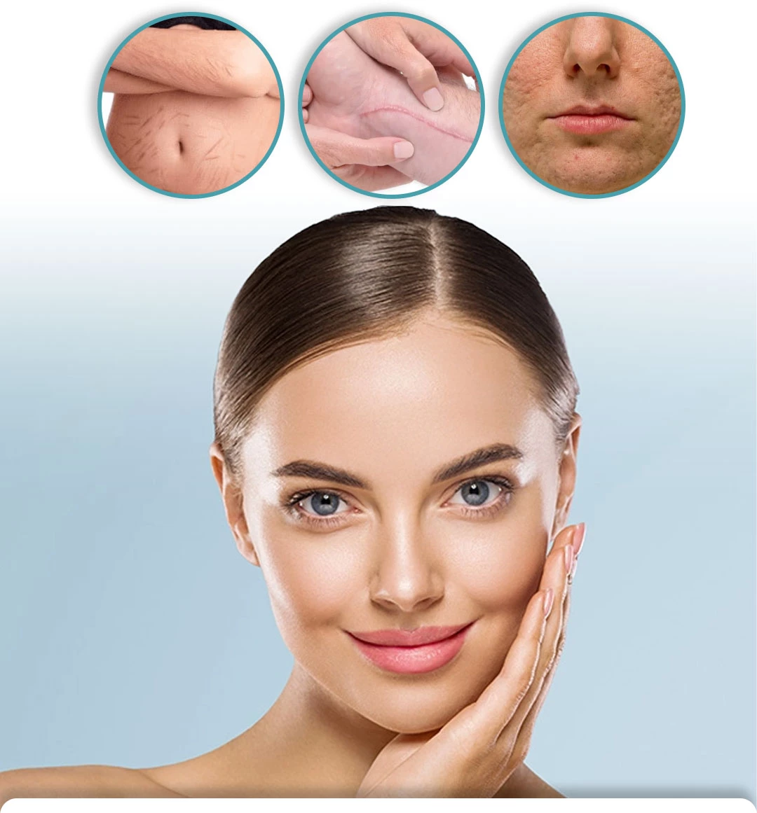 بخاخ مزيل الندبات