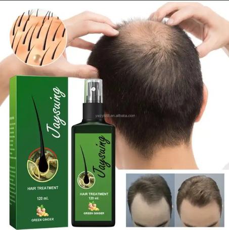 سائل جيسوينغ للشعر