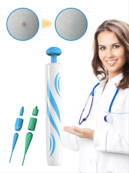 أداة ازالة علامات الجلد Skin Tag Remover الاكتر طلبا في العالم