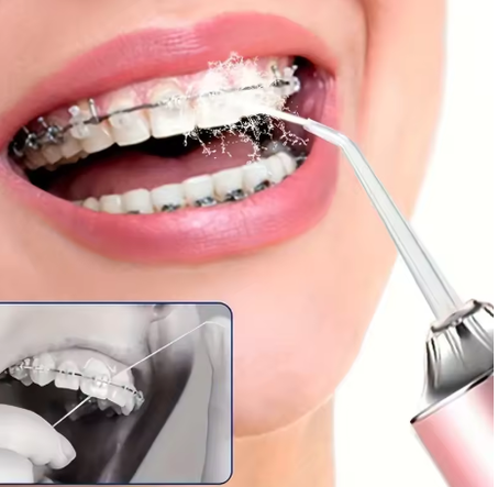 جهاز التنظيف المائي للأسنان