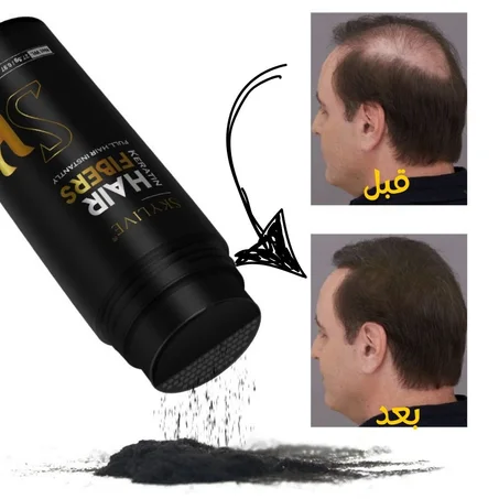 وداعاً للصلع اليوم