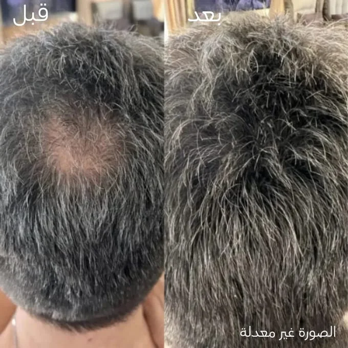 كريم الشعر Katef