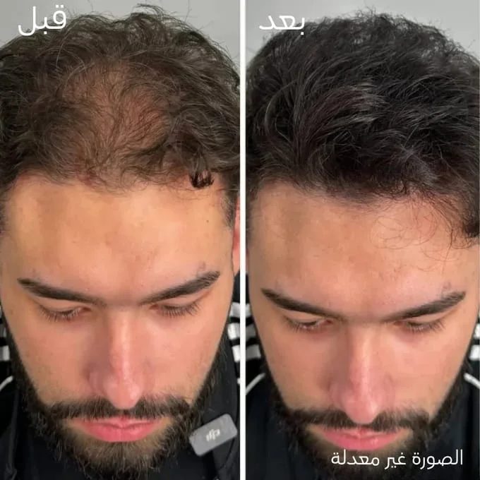 كريم الشعر Katef