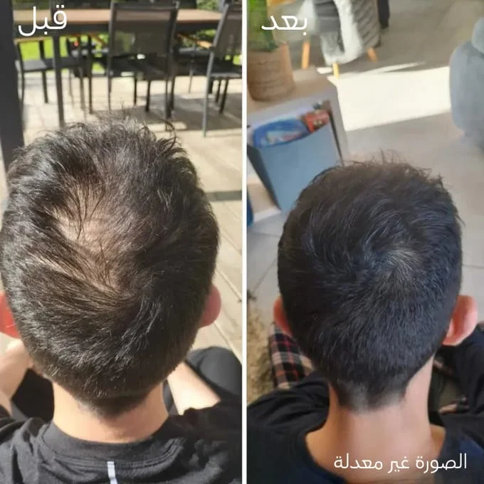 كريم الشعر Katef