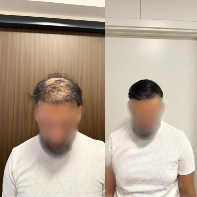 كريم الشعر Katef