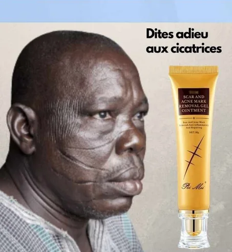 Crème très très efficace contre tout vos cicatrices de tout genre...