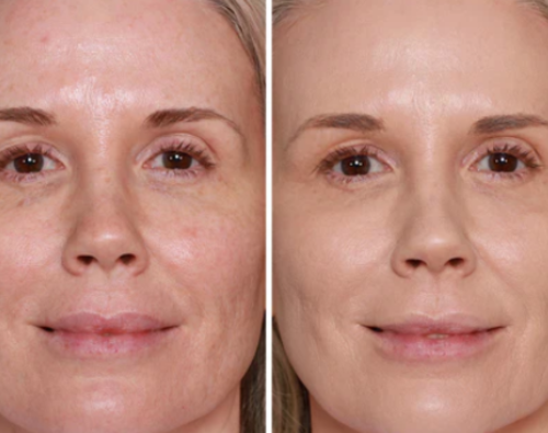 PEPTIDE BOUNCE BALM FOUNDATION