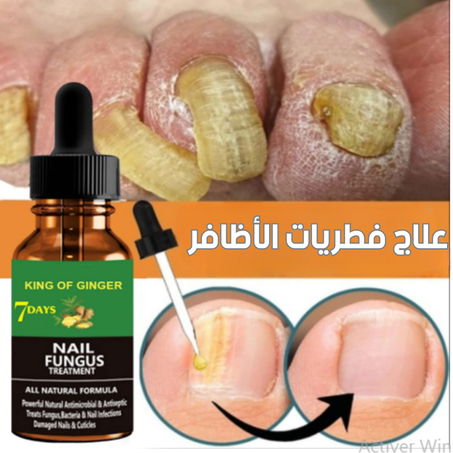 سيروم اصلاح الاظافر  الطبيعي