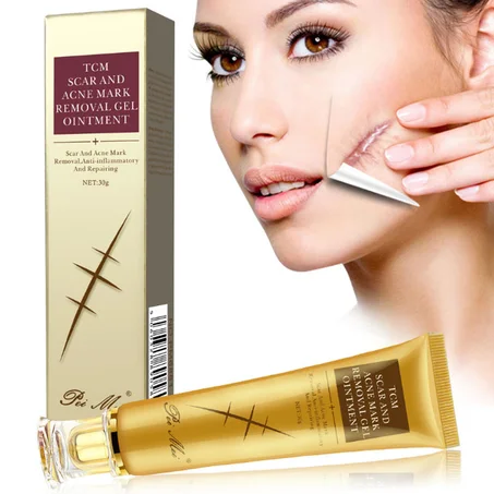 كريم تي سي إم لندبات