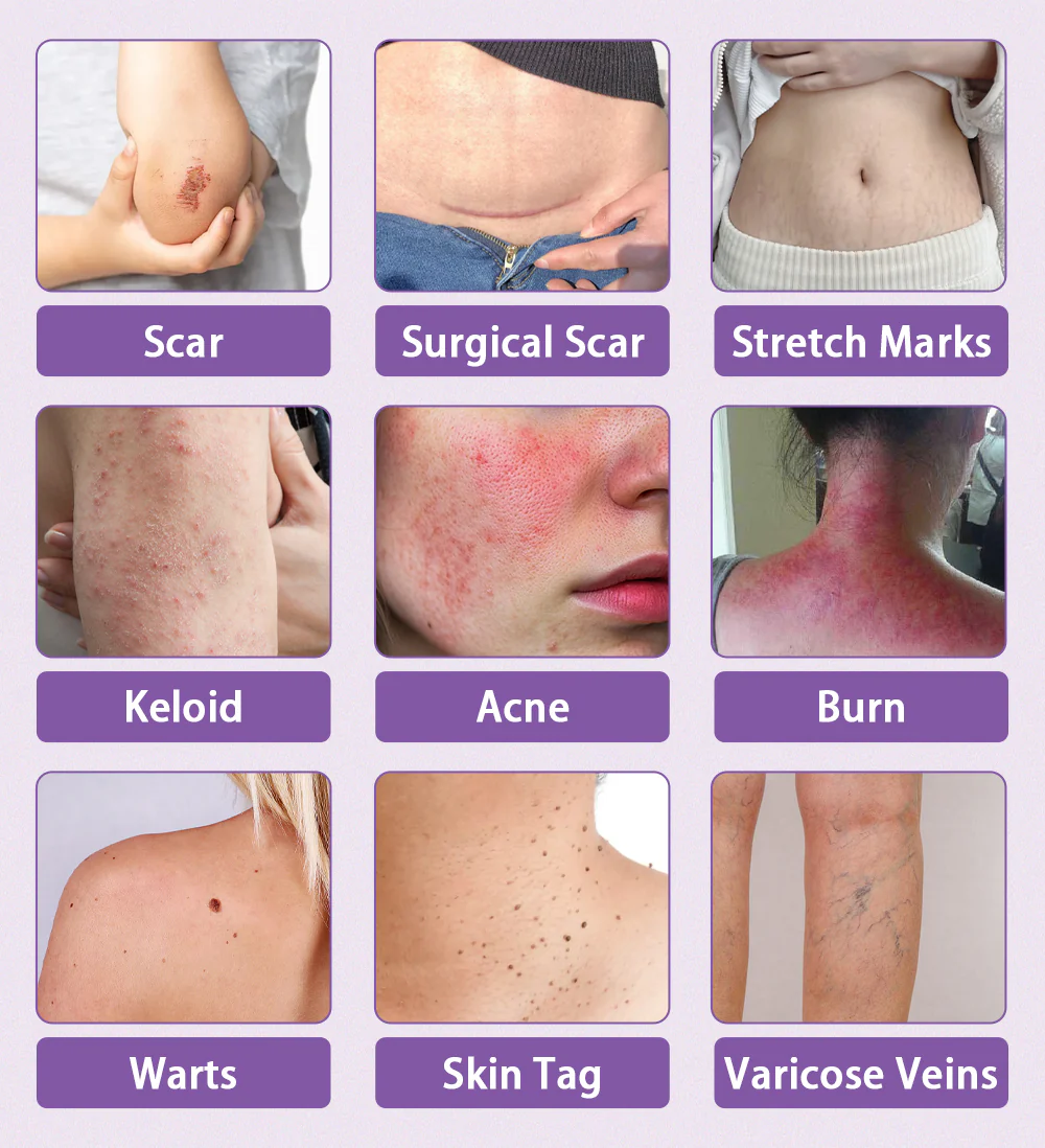 AHJgZlfzuEzNpU1SNQXtYuIpbnbqdpZsTjWLLPem