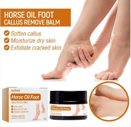 💎 The Ultimate Solution for Cracked Heels and Dry Feet!