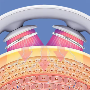 Masseur intelligent du dos et du cou, avec chauffage, impulsion TENS, Massage musculaire Cervical, sans fil, soulagement de la douleur des épaules, soins de santé