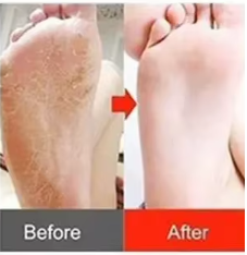 Outil de soin des pieds sans fil: Mini machine électrique de pédicure pour enlever les callosités des pieds