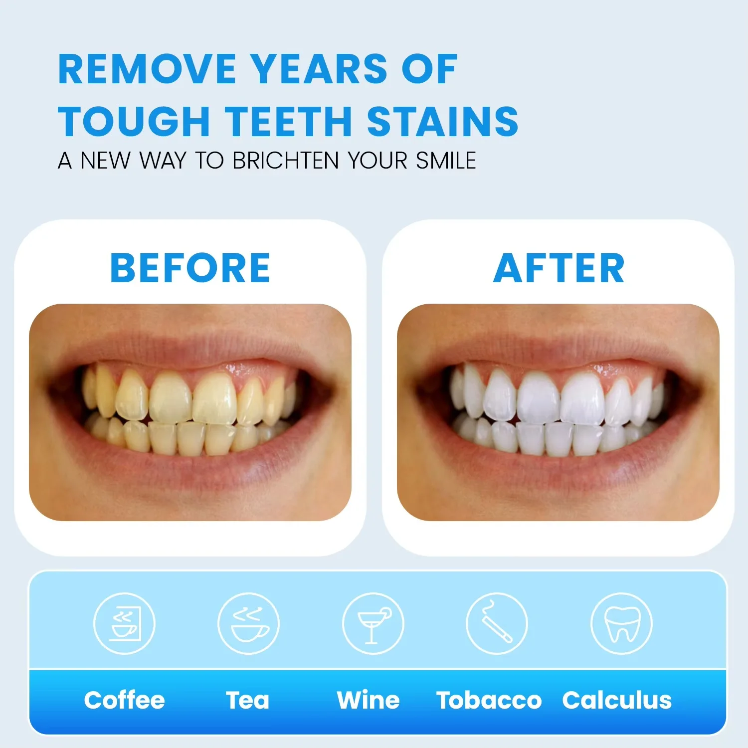 طقم تبييض أسنان قابل لإعادة الشحن 3 في 1