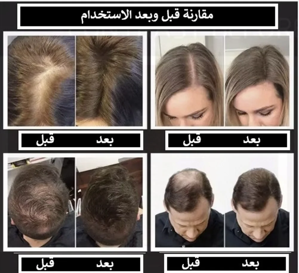 ألياف توبيك لتكثيف الشعر