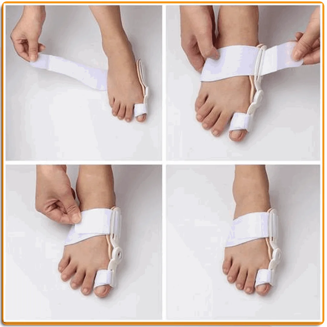 مصحح أصبع القدم الكبير