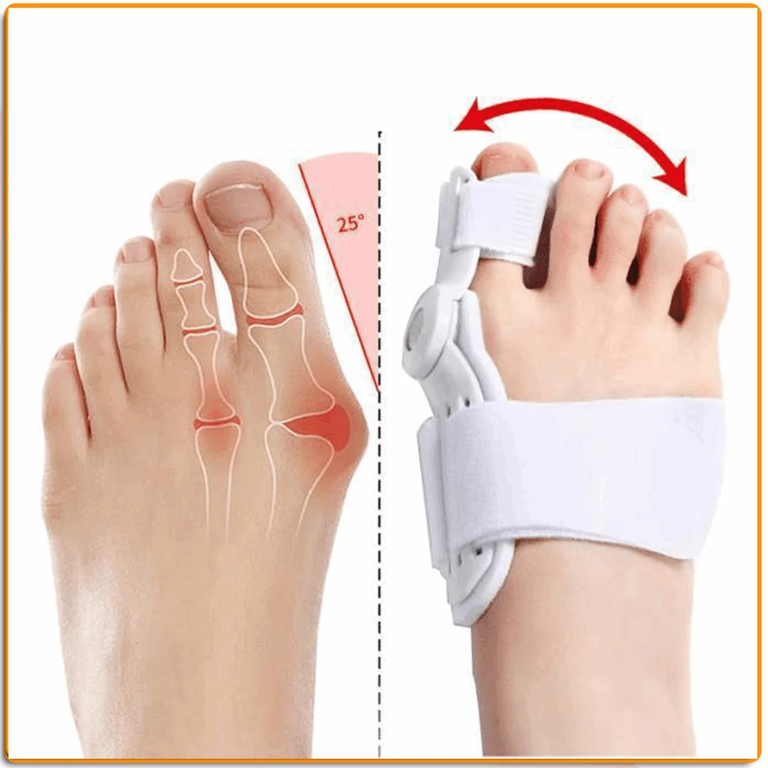 مصحح أصبع القدم الكبير