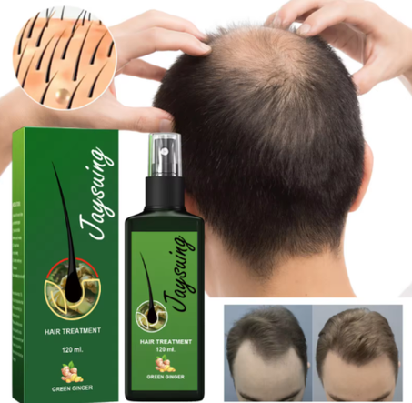 سيروم نمو الشعر