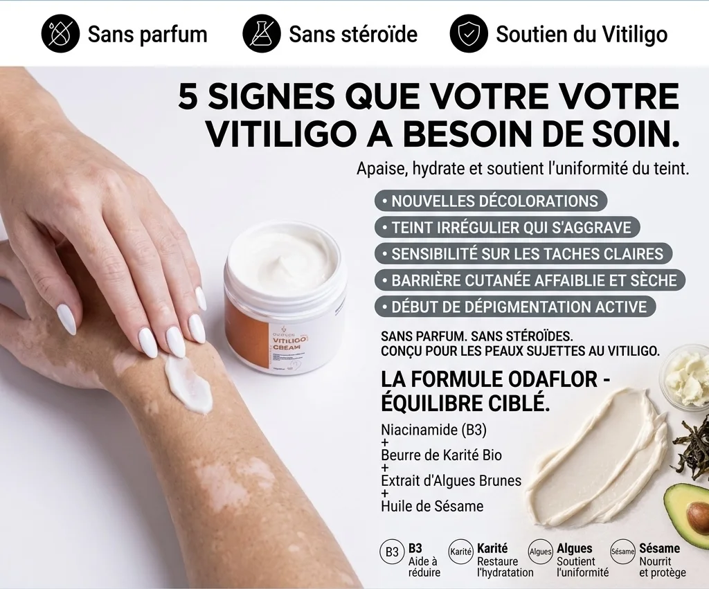 VITILIGO CREAM ODAFLOR