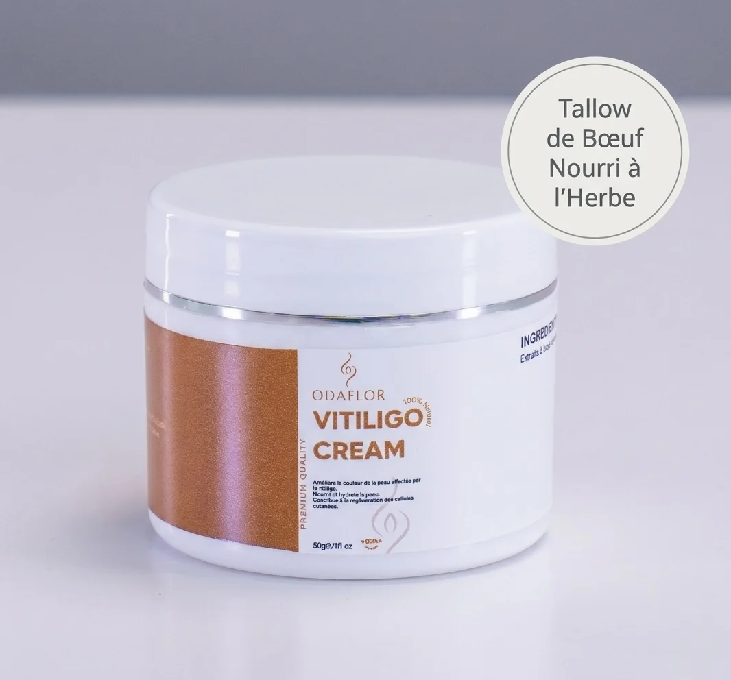 VITILIGO CREAM ODAFLOR
