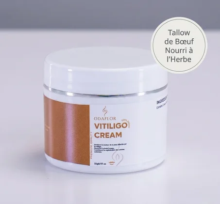 VITILIGO CREAM ODAFLOR