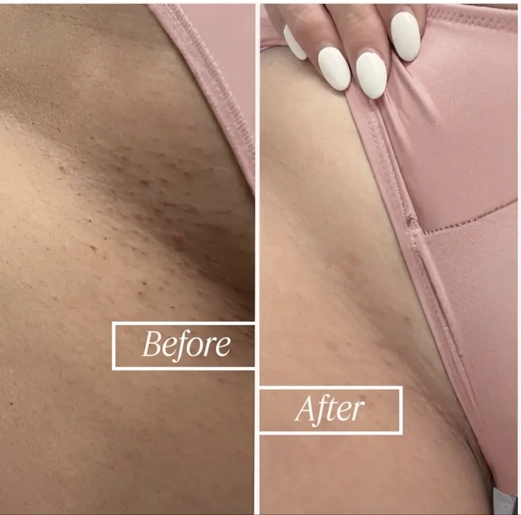 LUXE INTIMA ODAFLOR (tns)