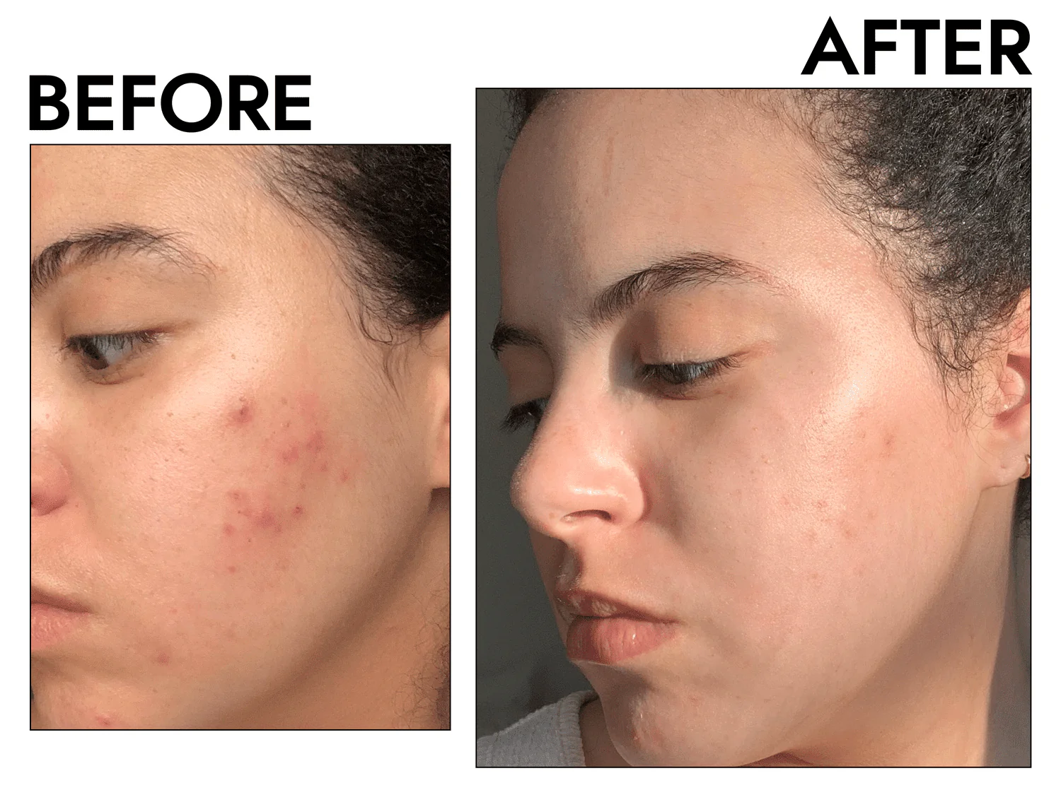 NIACINAMIDE ODAFLOR (copy)