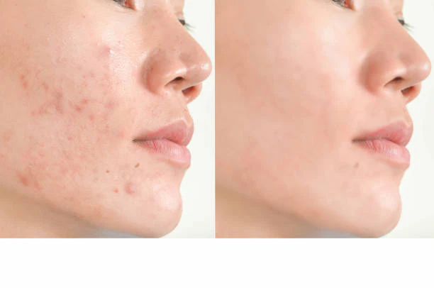 NIACINAMIDE ODAFLOR (copy)