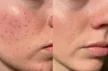 NIACINAMIDE ODAFLOR (copy)