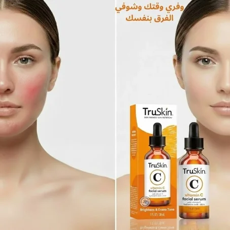 سيروم فيتامين C للوجه