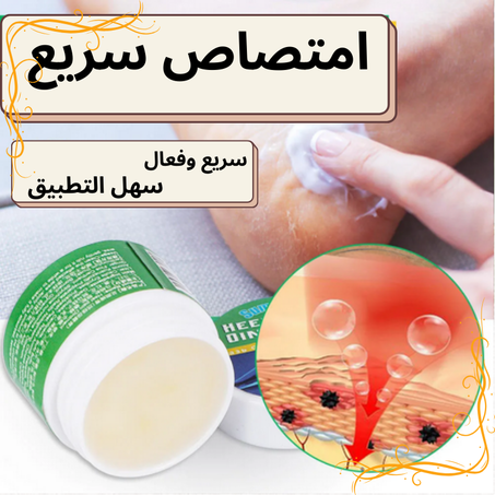 مرهم آلام الكعب